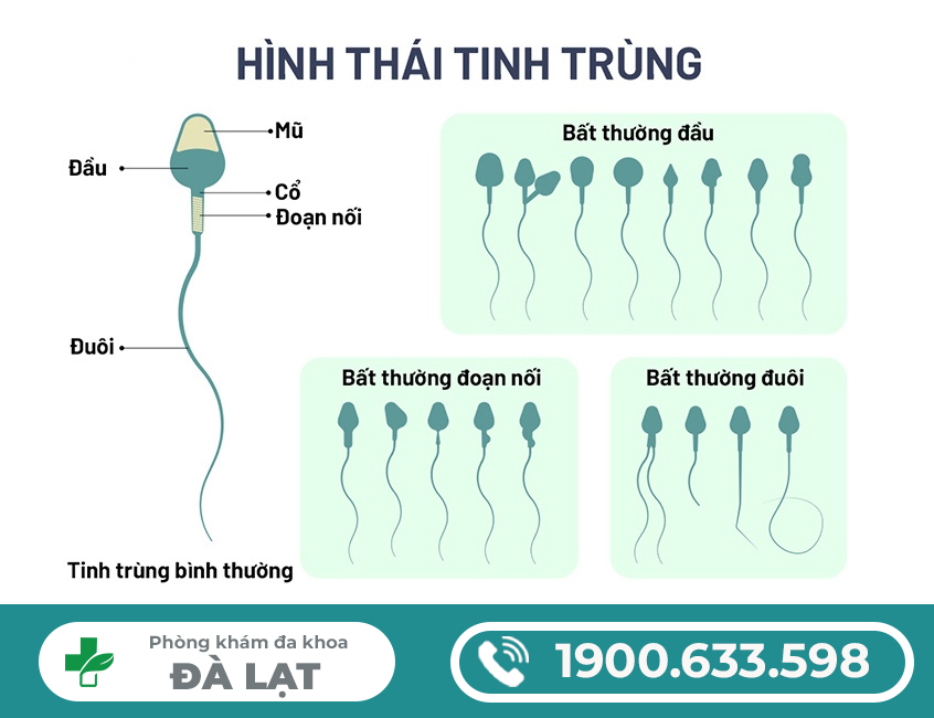 Hình ảnh minh họa